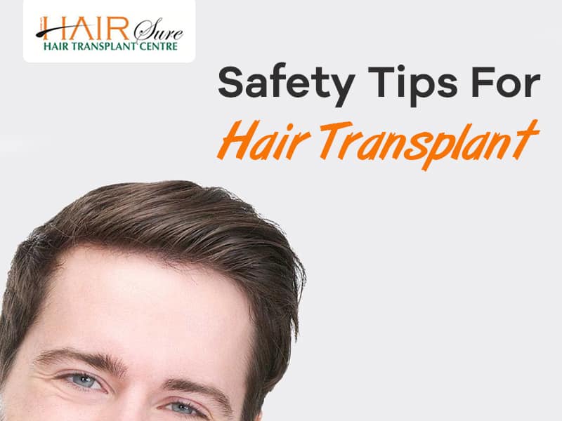 An Infographic About Safety Tips For Hair Transplant