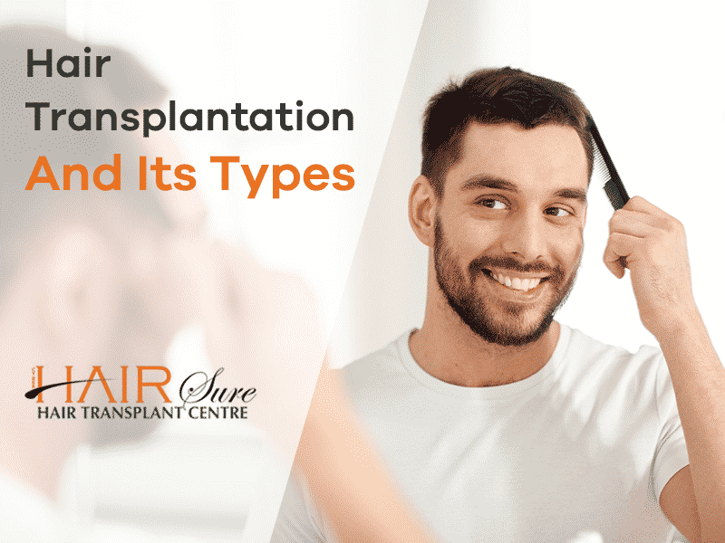 Hair Transplantation And It’s Types