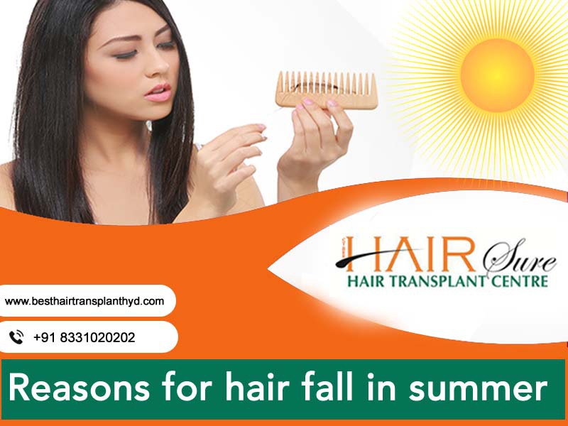 Reasons For Hair Fall In Summer - Cyber Hairsure