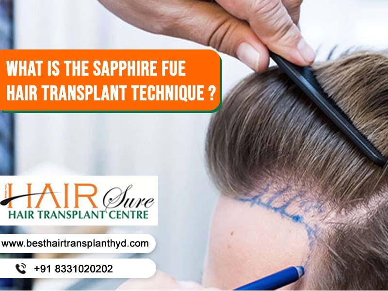 What is the Sapphire FUE hair transplant technique? - Cyber Hairsure