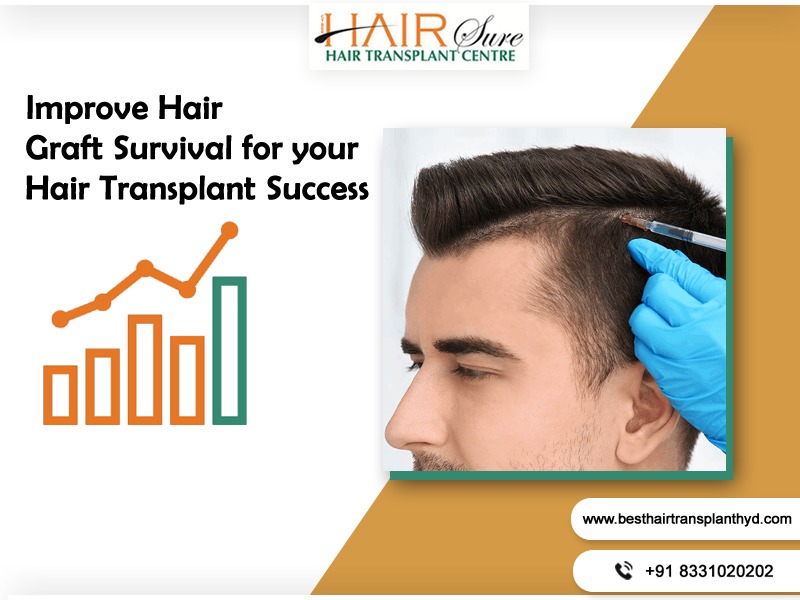 Improve Hair Graft Survival for your Hair Transplant Success