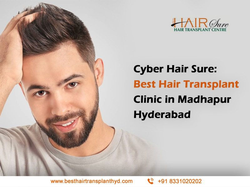 Cyber Hair Sure: Best Hair Transplant Clinic in Madhapur Hyderabad - Cyber  Hairsure